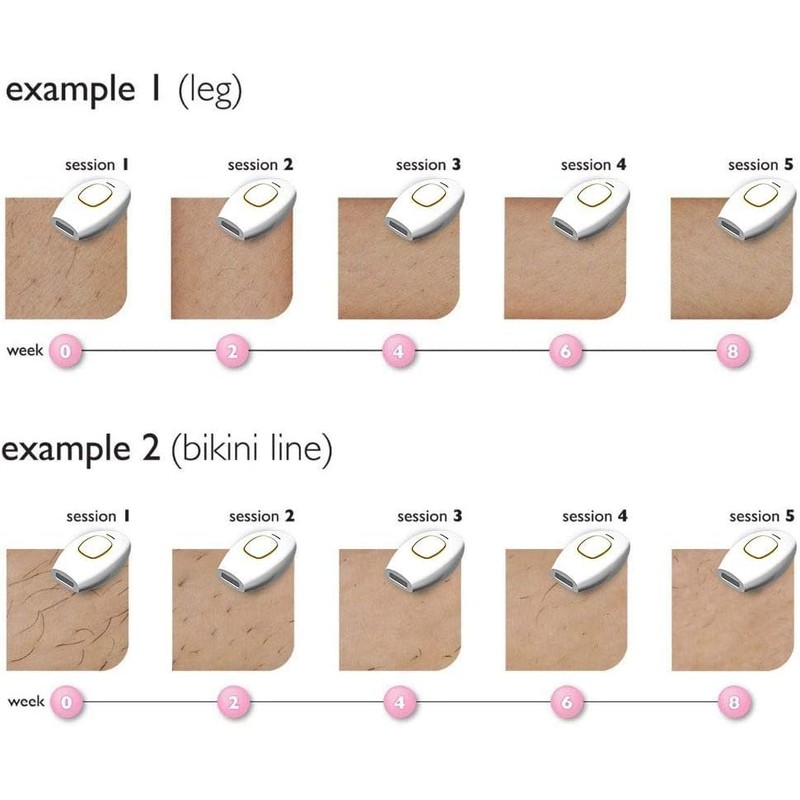 Límite-MX Depiladora de Luz Pulsada,Depilación Laser Profesional para Mujeres y