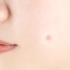 Pyunkang Yul [Pyunkang Yul]Clear Spot Patch (18ea * 4ea)