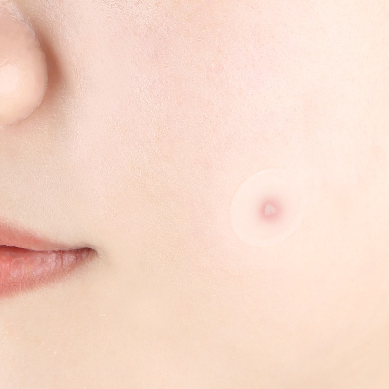 Pyunkang Yul [Pyunkang Yul]Clear Spot Patch (18ea * 4ea)