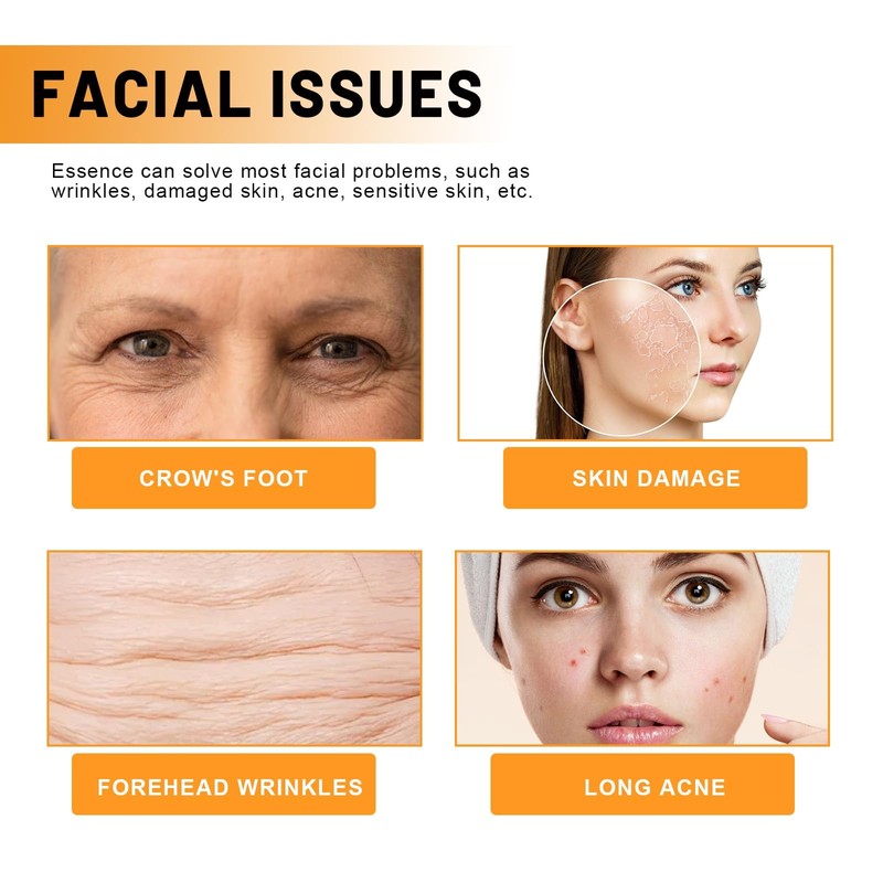 Vitamina C Facial Serum - Face Serum for Women, Intense