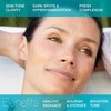 MD Complete Dark Spot Corrector | Anti-Aging | Professional Dark
