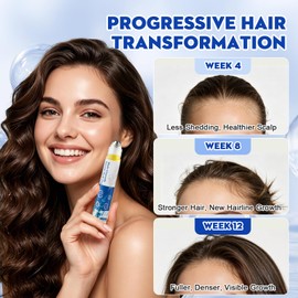 Rosemary Oil for Fuller-Looking Hair, Scalp Serum Roll On