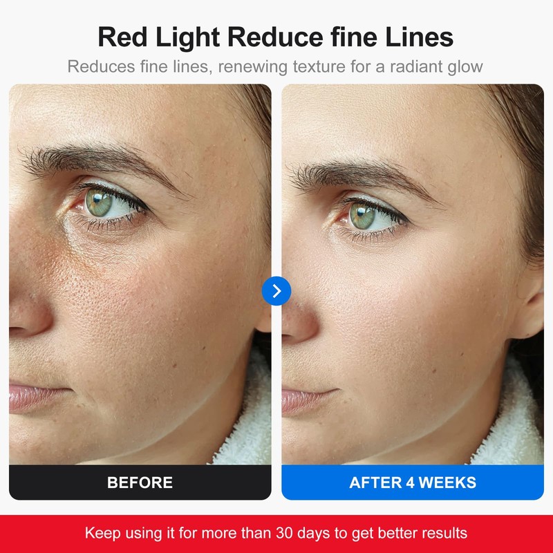 Profey LED Face Mask with 7 Colours, Red Light Mask