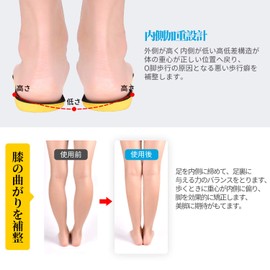 Insole, O Leg Correction, Arch Insole, Flat Leg, Arch Support, Plantar Fasciitis, O Leg X Leg Correction, Insole, Ergonomic, Shock Absorption, Reduces Stress on Knees and Lower Back, Prevents Fatigue,