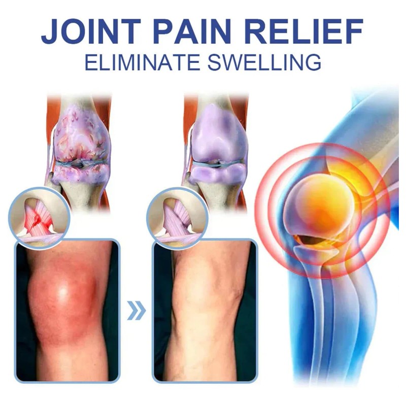 Crema Nutritiva Y Calmante Para Las Articulaciones