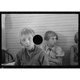 HistoricalFindings Photo: Son of Olaf Fugelburg,Farmer of Williams County,North Dakota,ND,Weeping Eczema,2