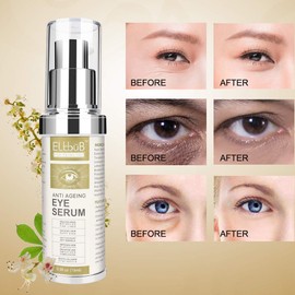 Eye Area Serum - Eye Cream - Anti-Ageing Eye Care Against Swollen Eyes, Hanging Eyelids, Dark Circles & Wrinkles with Vitamin E, Collagen - 15 ml