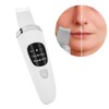 Face Skin Scrubber Vibration Face Peeling Machine Ultrasonic Exfoliating Skin‑Care