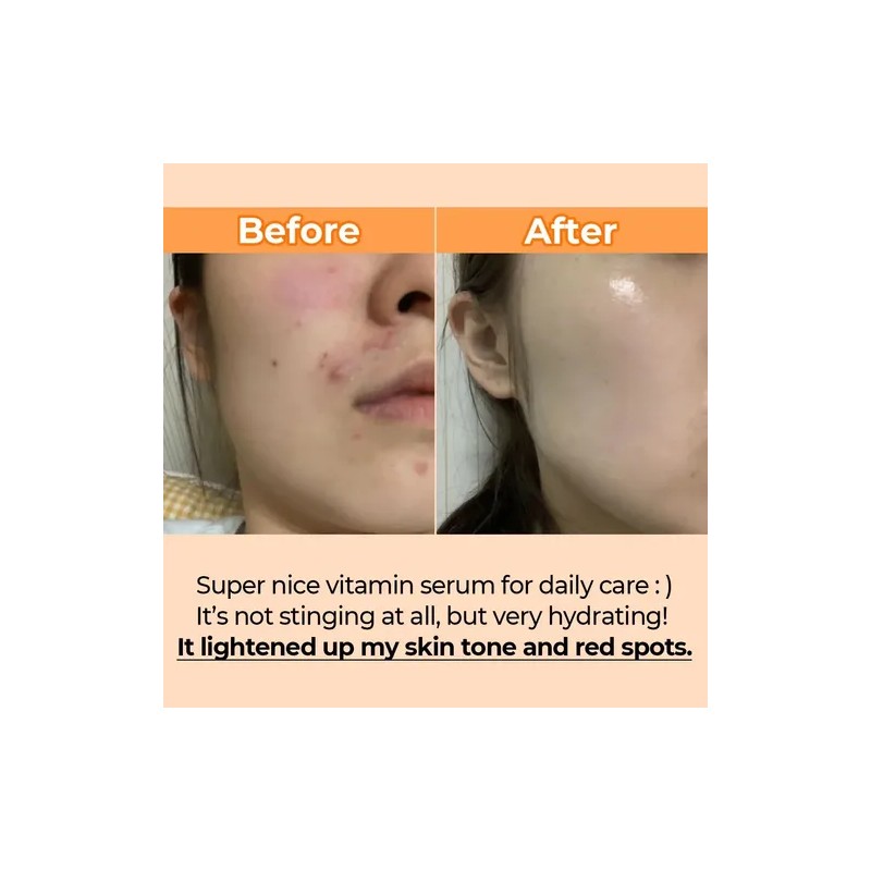 Numbuzin No.5 Goodbye Blemish Serum