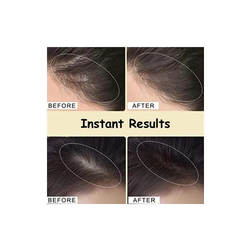 Corrector De Cabello Hairfillup Para Hombre, Hairfillup Hair