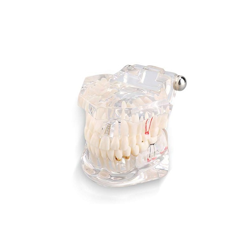 Modelo de dientes, modelo de práctica de enseñanza de dientes