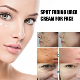 Crema De Urea Que Decolora Las Manchas, Crema De Urea Con Vi