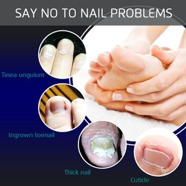 2025 4PCS Ingrown Toenail Clippers, Podiatrist Toe Nail File Lifter, Super Sharp Pedicure Tools, Curved Blade Nail Clipper, for Hard Thick Nail, Professional Manicure Kit