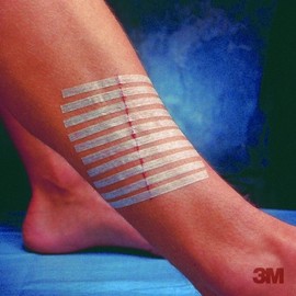 ステリストリップスタンダード R1547(12X100)6ホンX50フ