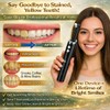 Electric Tooth Polisher