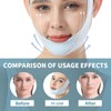 Reusable V-Line Mask, Chin Strap For Sleeping【Lifting Effect】【Skin Friendly】【Easy To