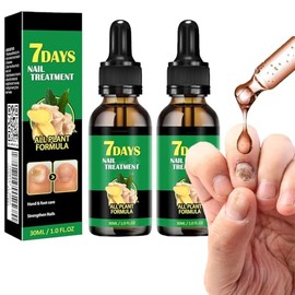 Ginger Nail Tratamiento Uñas Jengibre Soporte Cuidado Suero Crecimiento Aceite Fortalecedor