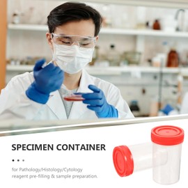 Hemobllo Specimen Cup, 25 Pcs 60ml Sample Cup Urine Container Specimen Collection Cups with Screw-on Lids Sample Collection Bottle for Laboratory (Random Color)