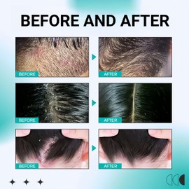 Bald Cream,Scalp Care Cream,Bald Head Moisturiser for Men,Post Shave Balm for Me-n,Me/n's Shaving Creams with Matte Effect,Ba/ld Head Moisturiser for M/en,Daily Scalp and Face Moisturiser for People