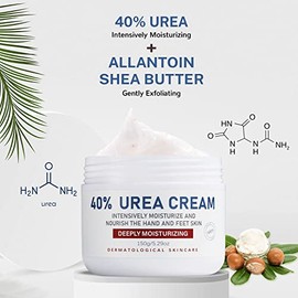 Crema de urea, 40 % loción para el cuidado de los pies para talones agrietados, talones agrietados, ultra, áspero, seco, pies callosos, suaviza la pie