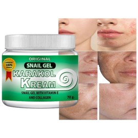 Karakol kream mancha oscura cara cuidado de la piel crema cara cara cara caracol, crema de caracol, humedad acné