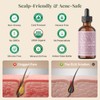 The ÉLIX USDA Organic Rosemary Oil for Hair Growth |