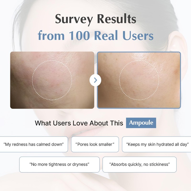 【TODAY With】 ソフト モイスチャー カーミング アンプル 100ml / 美容液 さっぱり