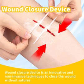 Pack of 3 Staple Plasters Wound Seam Strips for Closing Small Cuts Wounds with 10 Cotton Buds 6 Plasters Large