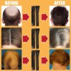 Gzbz Suero Orgánico For El Crecimiento Del Cabello En