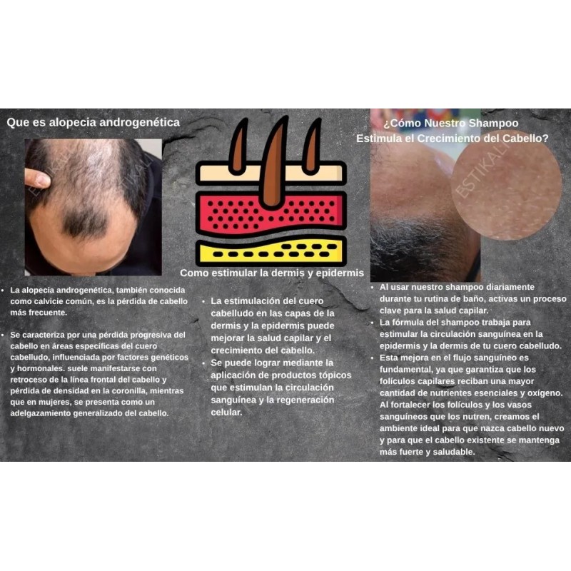 Shampoo Anticaída Anticaspa Antigraso Crecimiento De Cabello