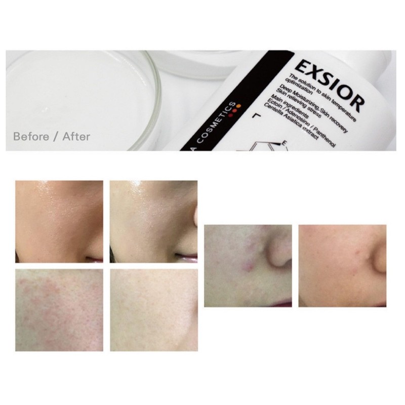 Philotica Exiol Portable Compact 1ml x 100 Sheets Highly Moisturizing