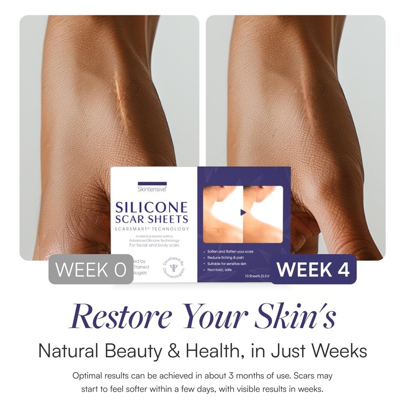 Scar Smart Scar Sheets - Scar Cream Strips for Surgical