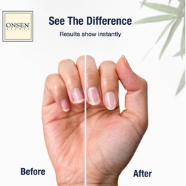 Onsen Secret Cuticle Cream 2pk, Cuticle Oil in Deep Action - Japanese Natural Healing Minerals Nail Care Serum. Sooth, Repair, & Strengthen Cuticles & Nails, Visible Results, Non-Greasy - 2x15ml