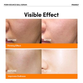 FRANKLY [FRANKLY]PDRN Bounce Ball Serum 30ml