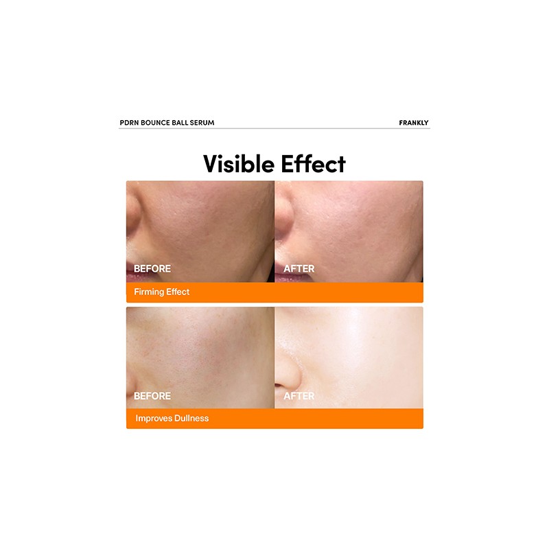 FRANKLY [FRANKLY]PDRN Bounce Ball Serum 30ml