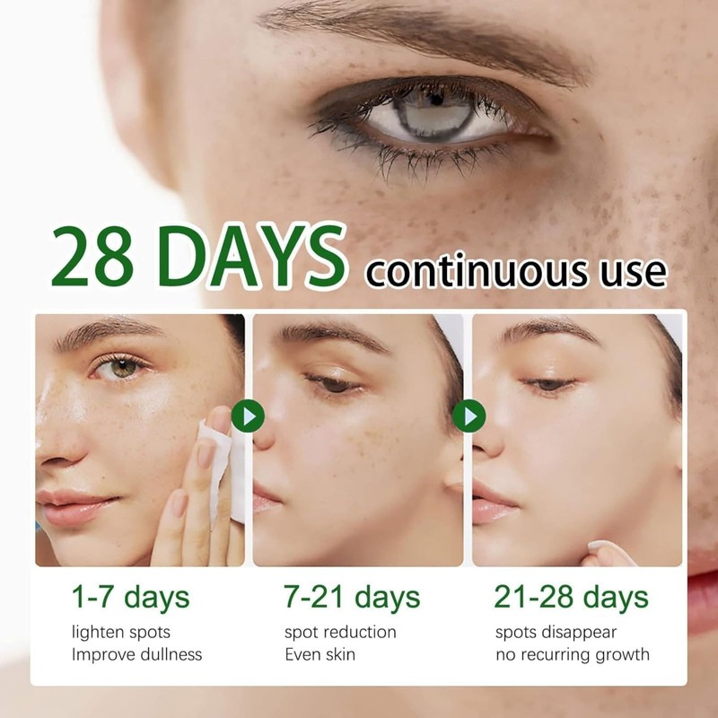 Crema para Manchas Oscuras en La Cara, Cremas para Quitar