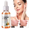 Turmeric Serum for Dark Spots, Reduces Hyperpigmentation, Age Spots, Sun
