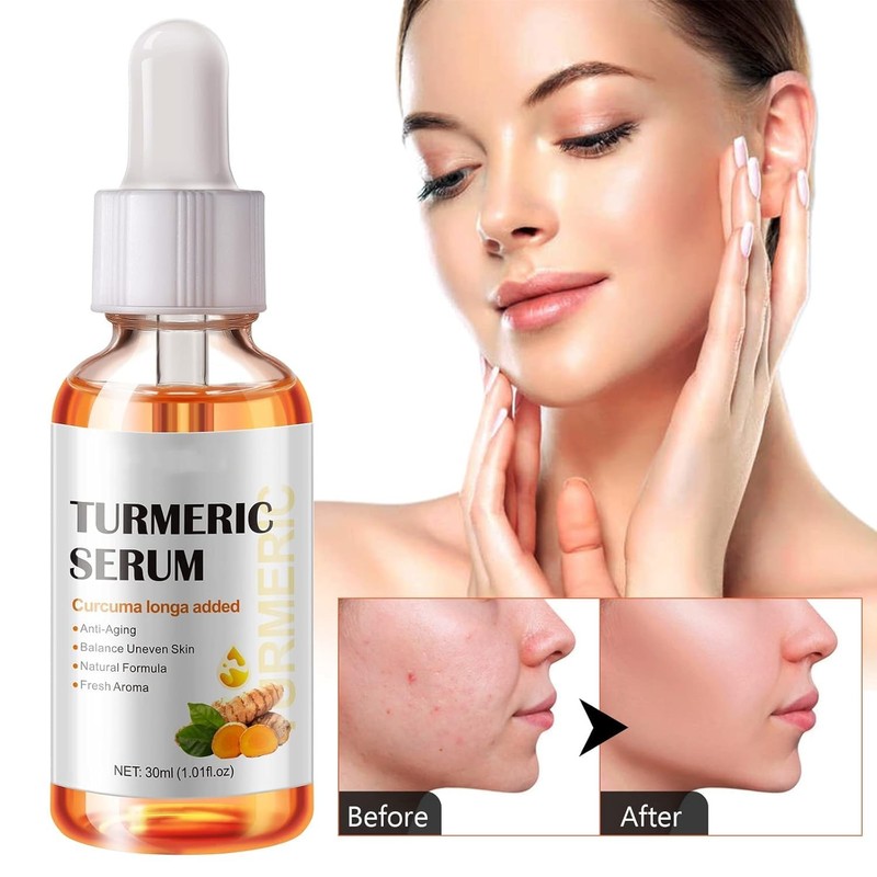 Turmeric Serum for Dark Spots, Reduces Hyperpigmentation, Age Spots, Sun