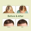 Kit de aceite vegano natural para el crecimiento del cabello,