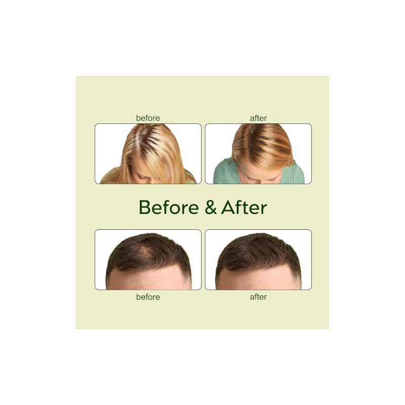 Kit de aceite vegano natural para el crecimiento del cabello,
