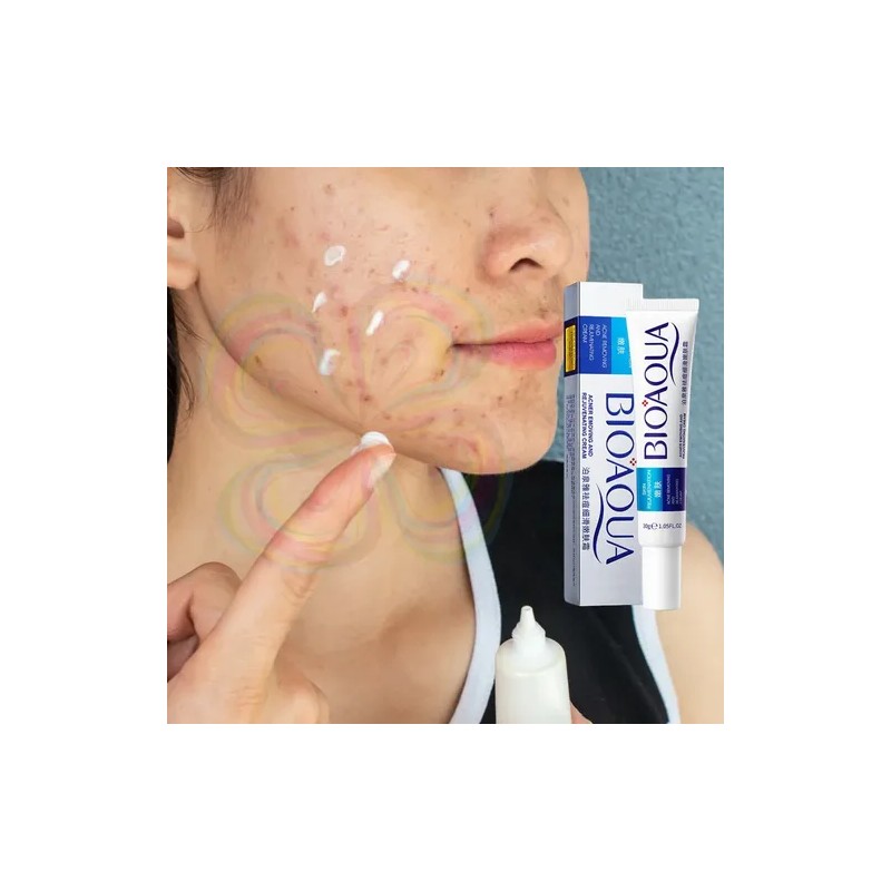 Crema Cicatrices Poros Control De Grasa Acne Cream 2pz Full