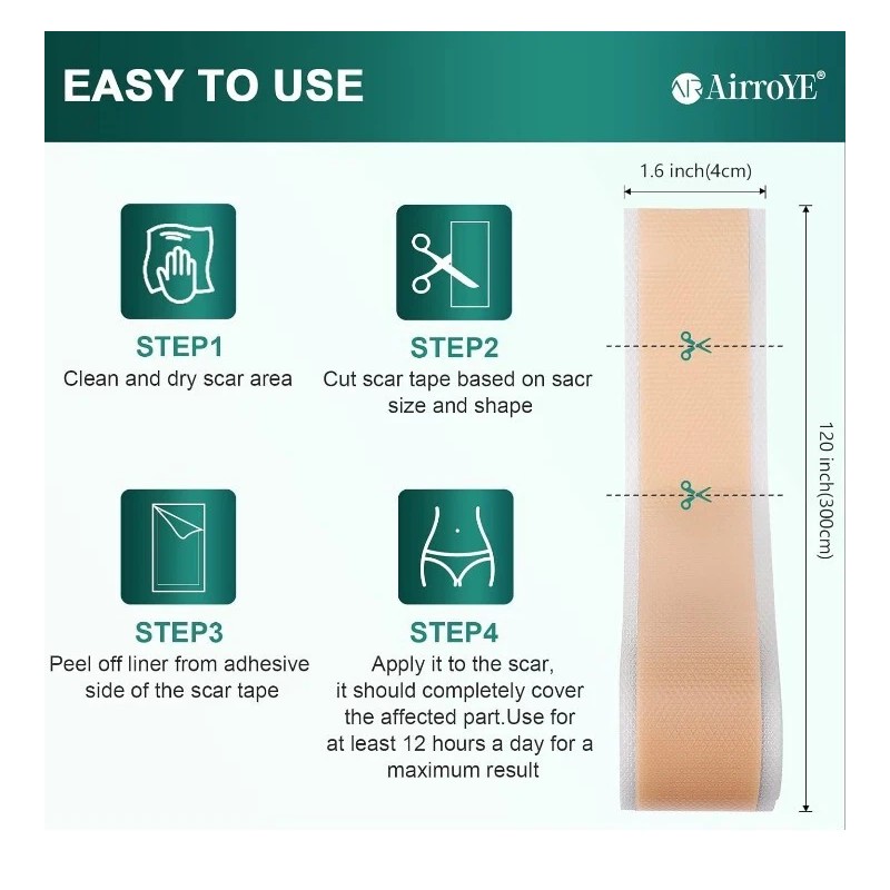 Airroye 1 Roll Silicone Adhesive Scar Sheets 1.6" x 120