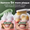 ODAY - Cepillo de dientes eléctrico Sonic para adultos con