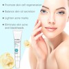 Bluemega Gel Hidratante con Niacinamida para el Acné