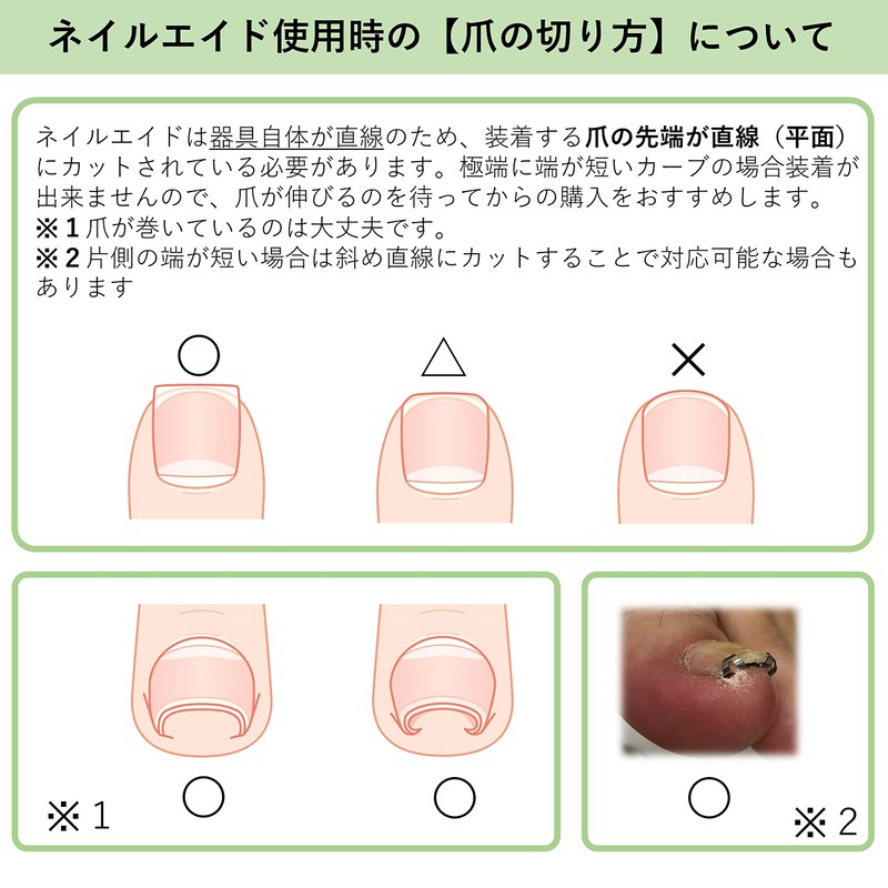 Nail Aid 0.6 inch (14 mm) Winding Nail Correction Self-Winding