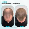 SURETHIK Hair Fibers, 15g (Black), Fills Thinning Hair for Visibly