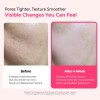 Dr.melaxin Cemenrete Cyano Pink Serum Reducir Poros