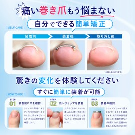 Winding Nail Clip, Intrapeze, Makizume, Winding Nail, Tighten, Curled Nail Correction, Dr Nail Doctor Nail, Medium Size, Set of 2