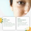 Spots Removal Serum, Niacinamide Serum for Face, Dark Spot Correcting