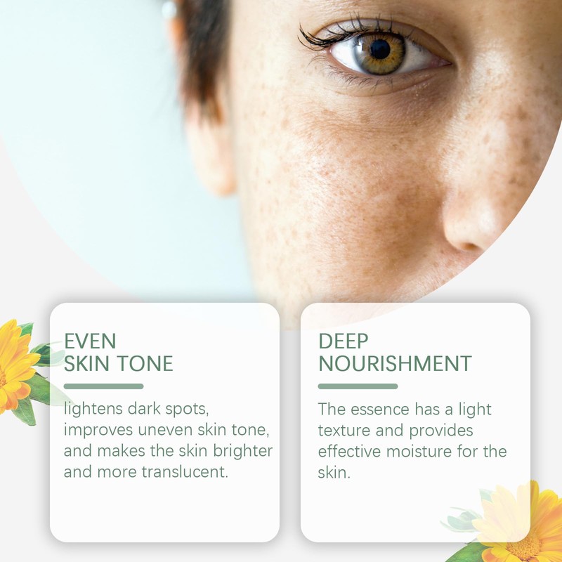 Spots Removal Serum, Niacinamide Serum for Face, Dark Spot Correcting